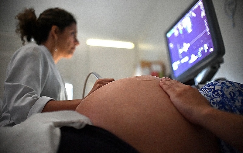 Exames de ecocardiograma e ultrassonografias poderão ser feitos pelo SUS