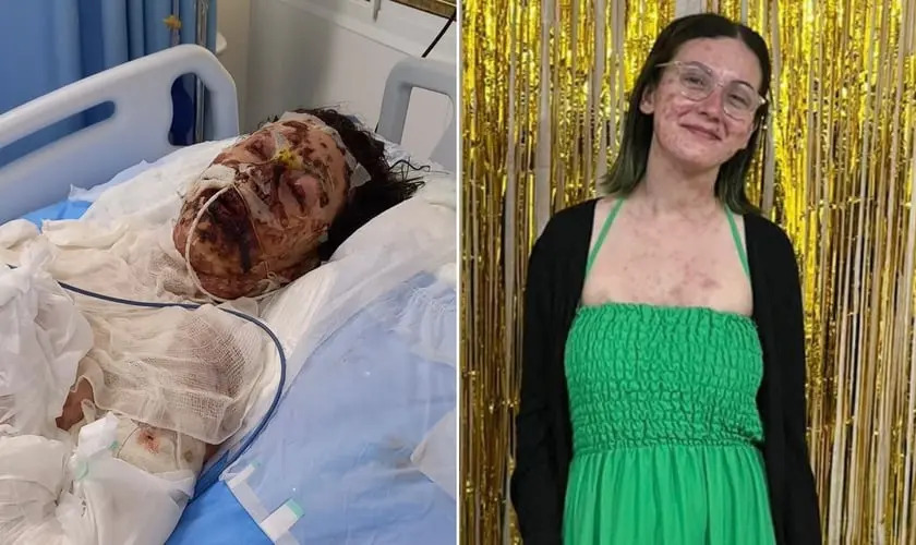 Filha de pastores sobrevive a síndrome rara e testemunha: “Deus tem um propósito na minha vida”