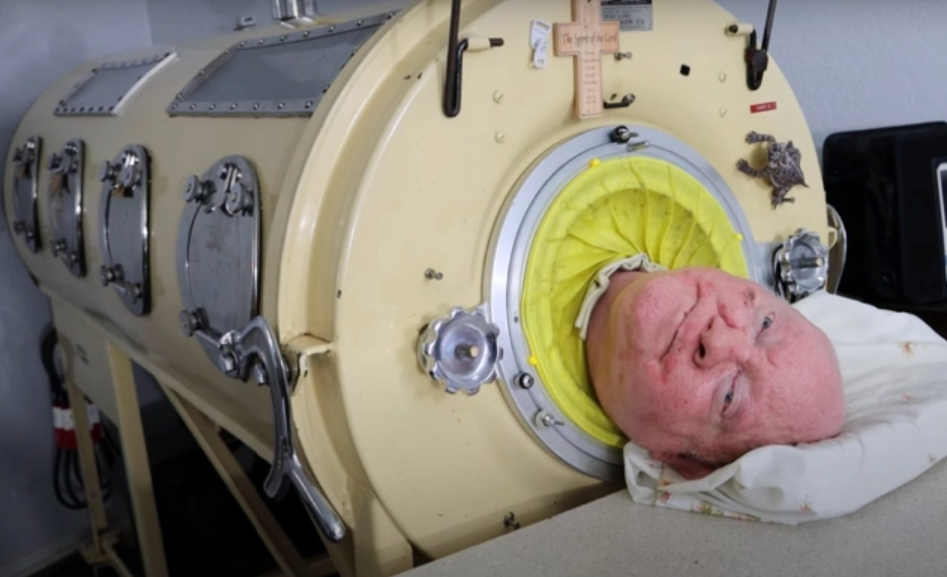 Homem que passou 70 anos em pulmão de ferro falou sobre amor de Deus